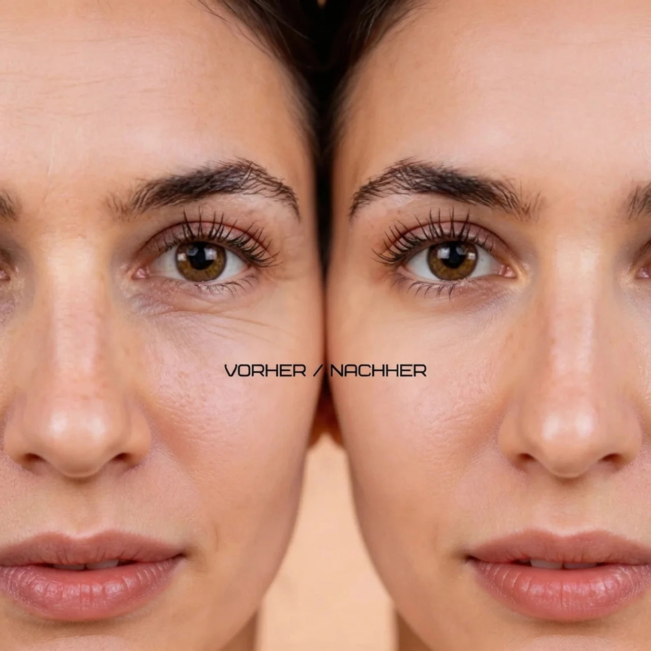 Lumière Micro Needle Eye Patches